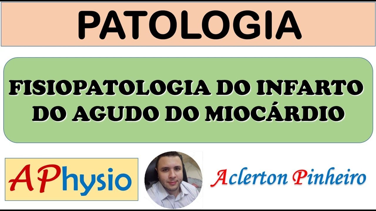 Entendendo A Fisiopatologia Do Infarto Agudo Do Mioc Rdio Causas E