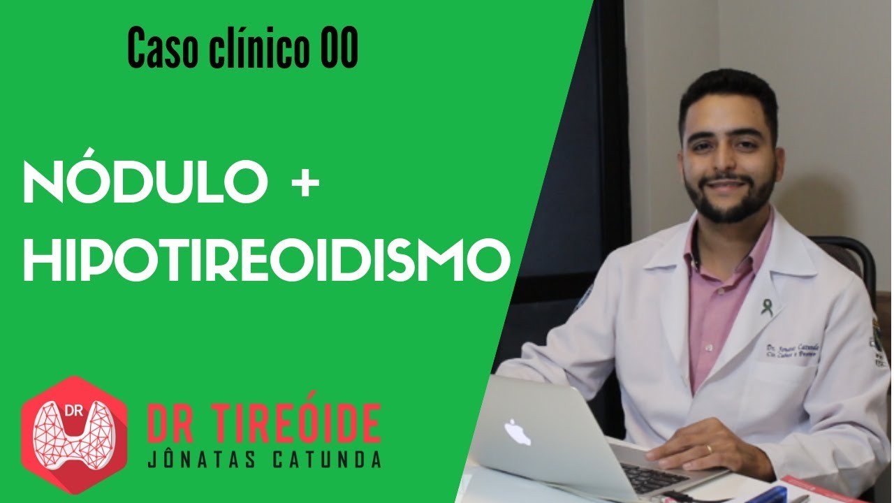 Tratamento de Hipotireoidismo e Nódulos na Tireoide Estudo de Caso