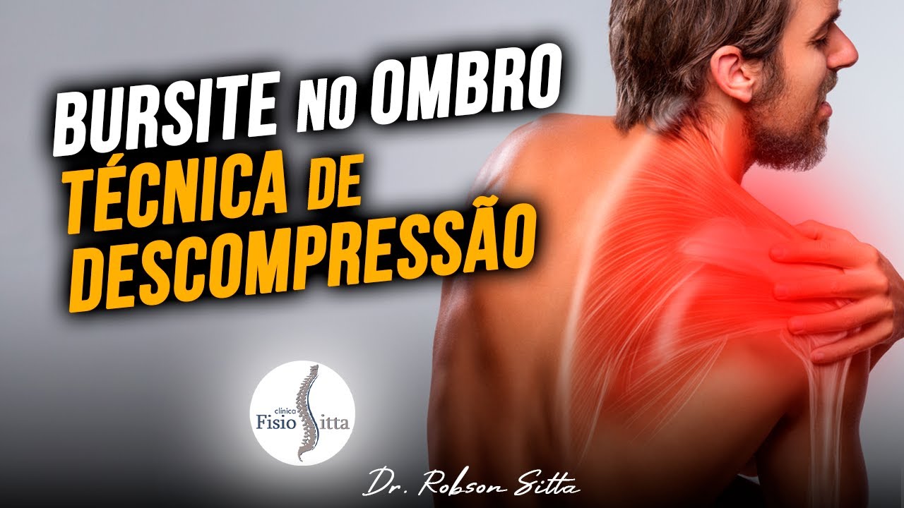 Tratamento De Bursite No Ombro Fisioterapia Descompressiva E