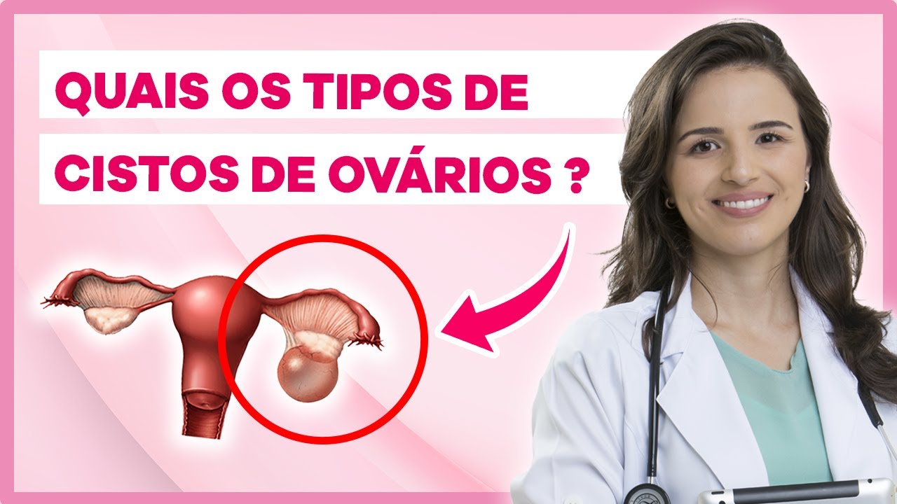 Cistos Ovarianos Tipos e Indicações para Cirurgia