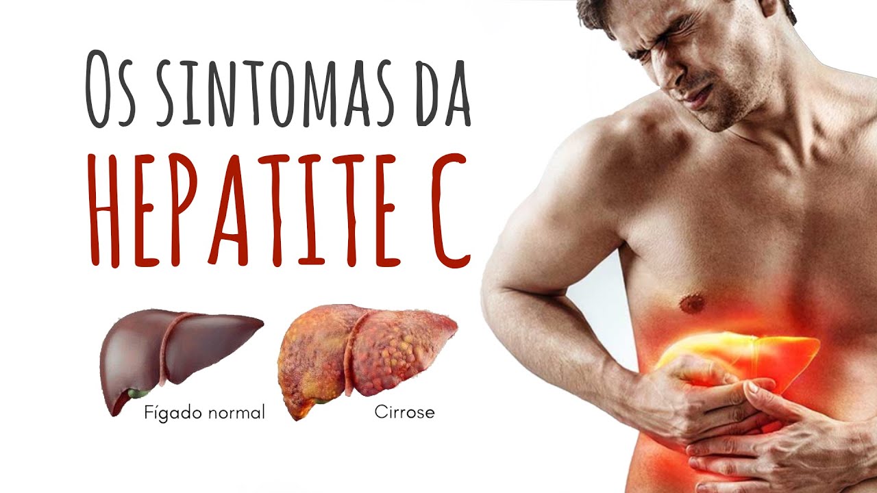 Conheça os sintomas da Hepatite C e como identificá los