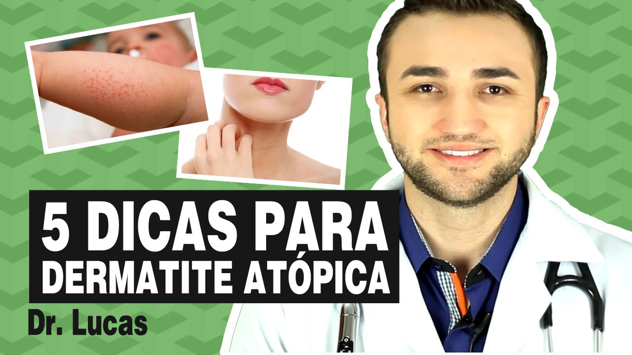 Dermatite At Pica Em Crian As Dicas Para Aliviar Alergias