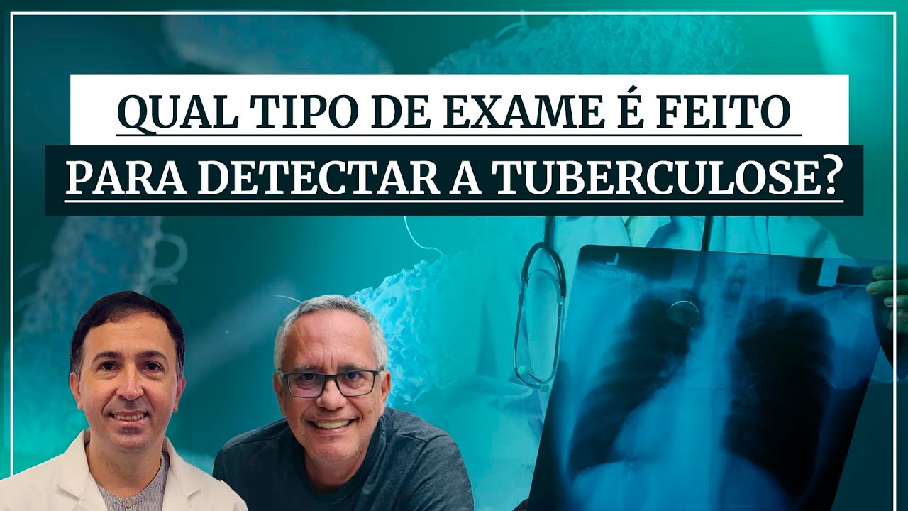 Descubra Como Detectar A Tuberculose Com Dr Gustavo Cabral 7008