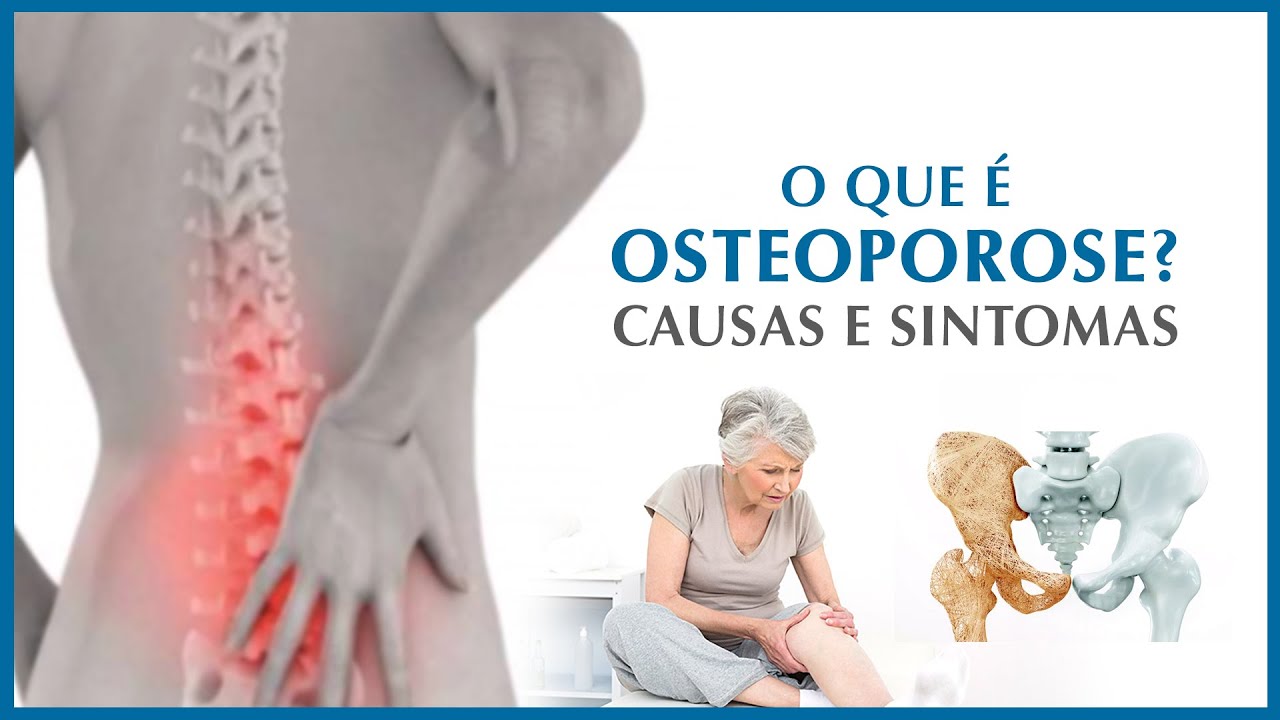 Osteoporose Causas E Sintomas Da Perda De Massa Ssea