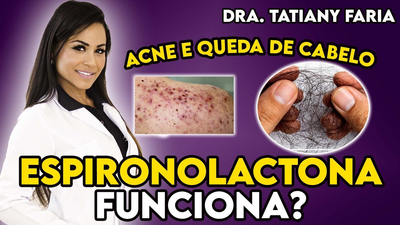 Tratamento de acne e queda de cabelo com Espironolactona.