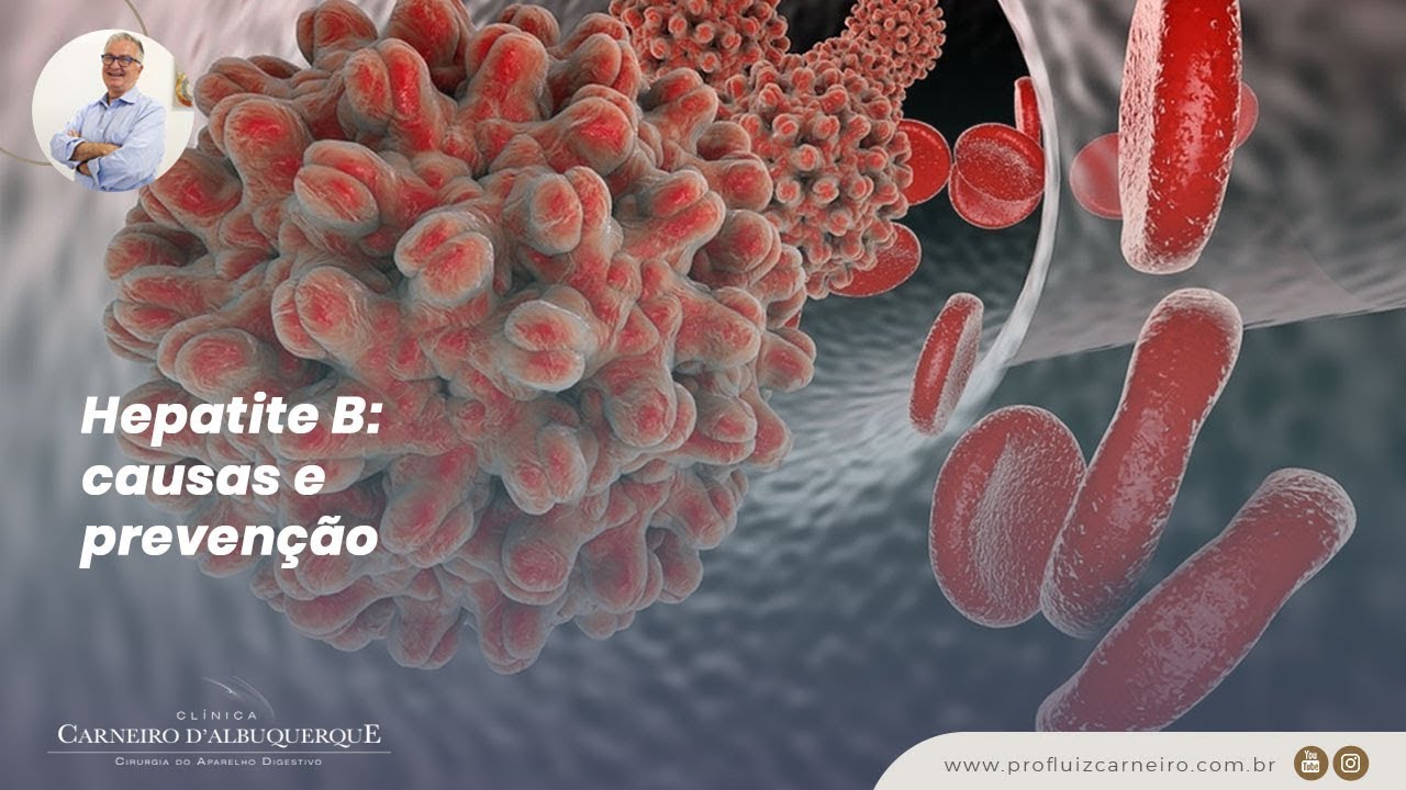 Hepatite B: causas, prevenção e informações importantes com o Prof. Dr ...