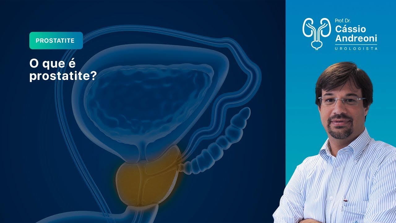 Prostatite - Entenda Sintomas e Tratamentos | Dr. Cássio Andreoni CRM ...
