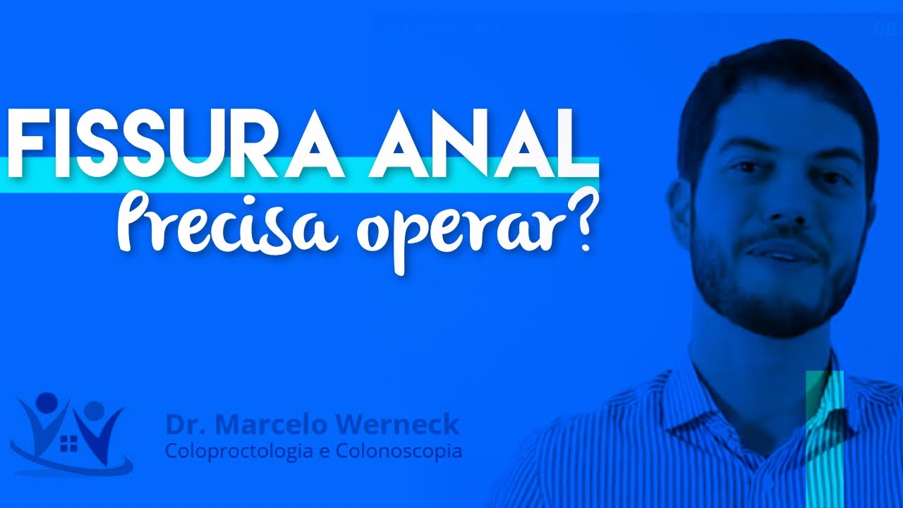 Tudo O Que Você Precisa Saber Sobre Fissura Anal Dr Marcelo Werneck