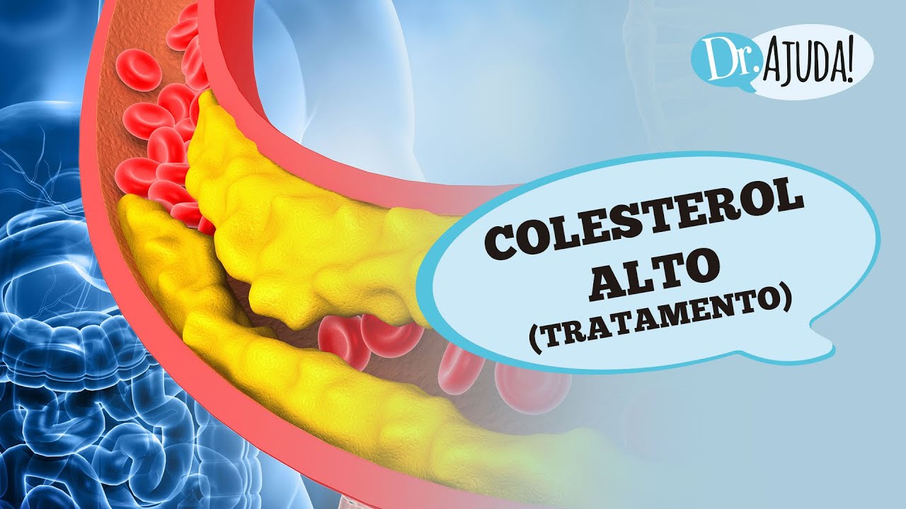 Como Baixar E Prevenir O Colesterol Alto 8875